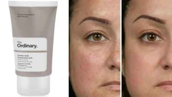 The Ordinary Azelaic Acid Suspension 10% 30ml - Image 4