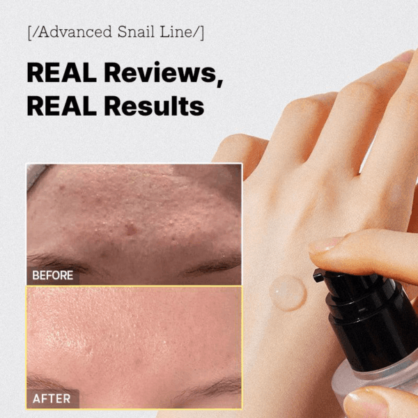 Cosrx Advanced Snail 96 Mucin Power Essence 100ml - Image 3