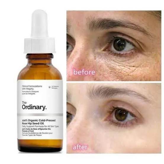 The Ordinary 100% Organic Cold Pressed Rose Hip Seed Oil 30ml - Image 3