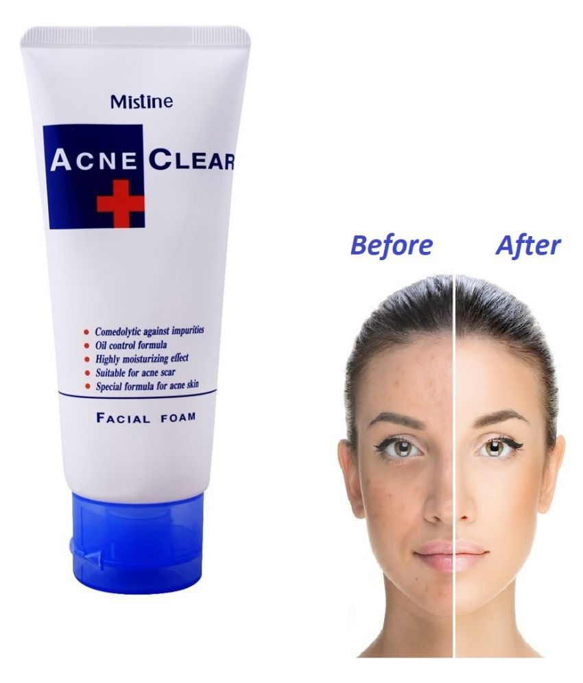 Mistine Acne Clear Facial Foam Face Wash 85g - Image 5