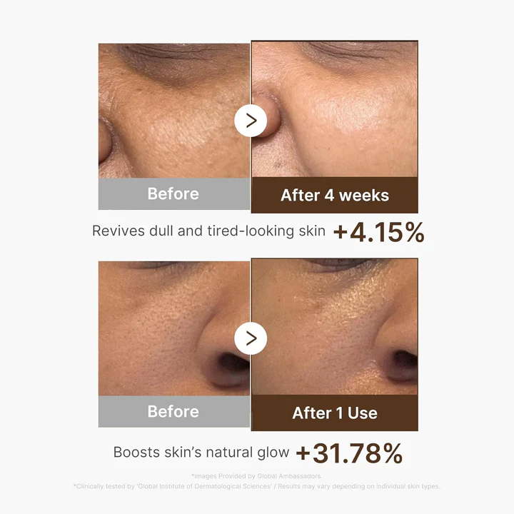 Medicube Deep Vita C Capsule Serum 30ml - Image 4